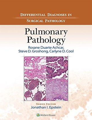 Read Differential Diagnosis in Surgical Pathology: Pulmonary Pathology - Rosane Duarte Achcar file in ePub