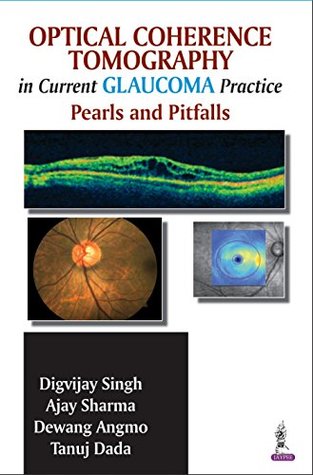 Read Optical Coherence Tomography in Current Glaucoma Practice Pearls and Pitfalls - Singh Digvijay file in PDF