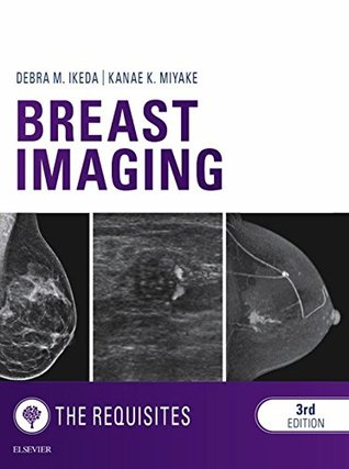 Download Breast Imaging: The Requisites E-Book (Requisites in Radiology) - Debra Ikeda | PDF