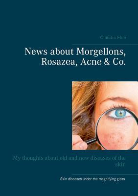 Read online News about Morgellons, Rosazea, Acne Co.: My thoughts about old and new diseases of the skin - Claudia Ehle file in ePub